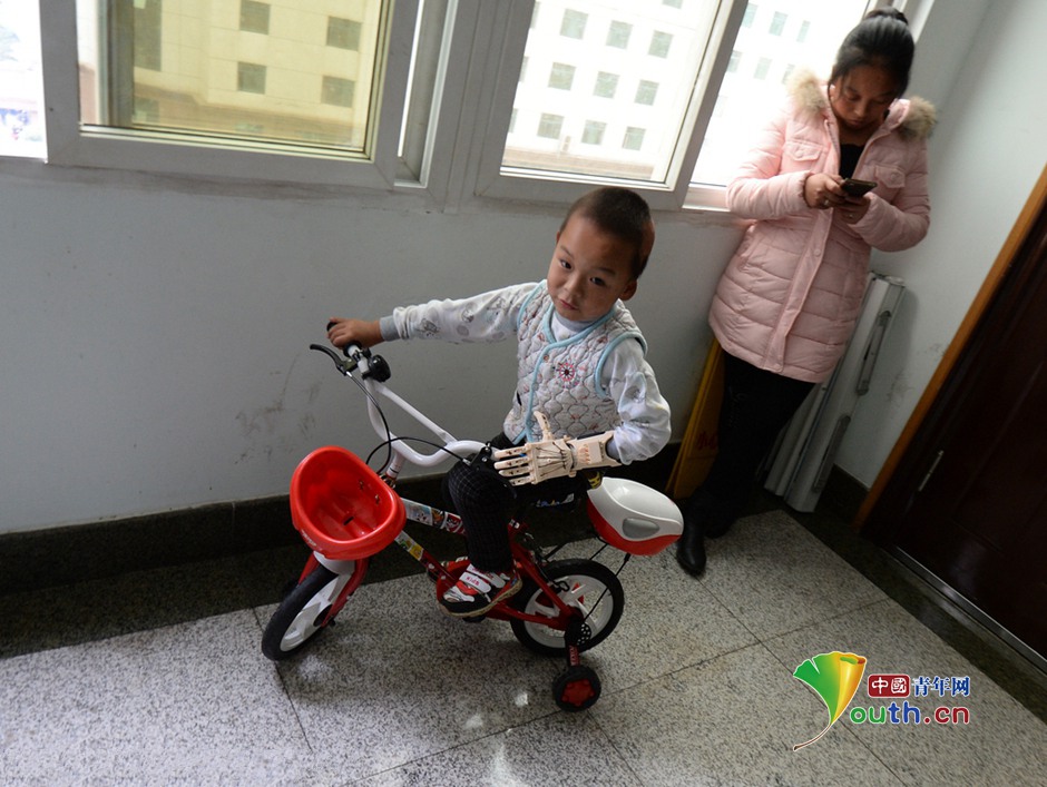 Boy regains his hand thanks to 3D printing