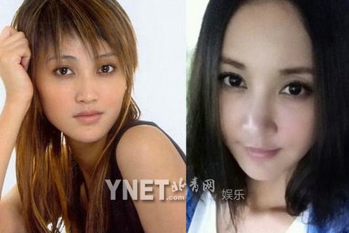 China to be the third largest country of plastic surgery