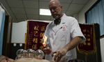 TCM cupping technique lures foreign doctors to learn and practice in China