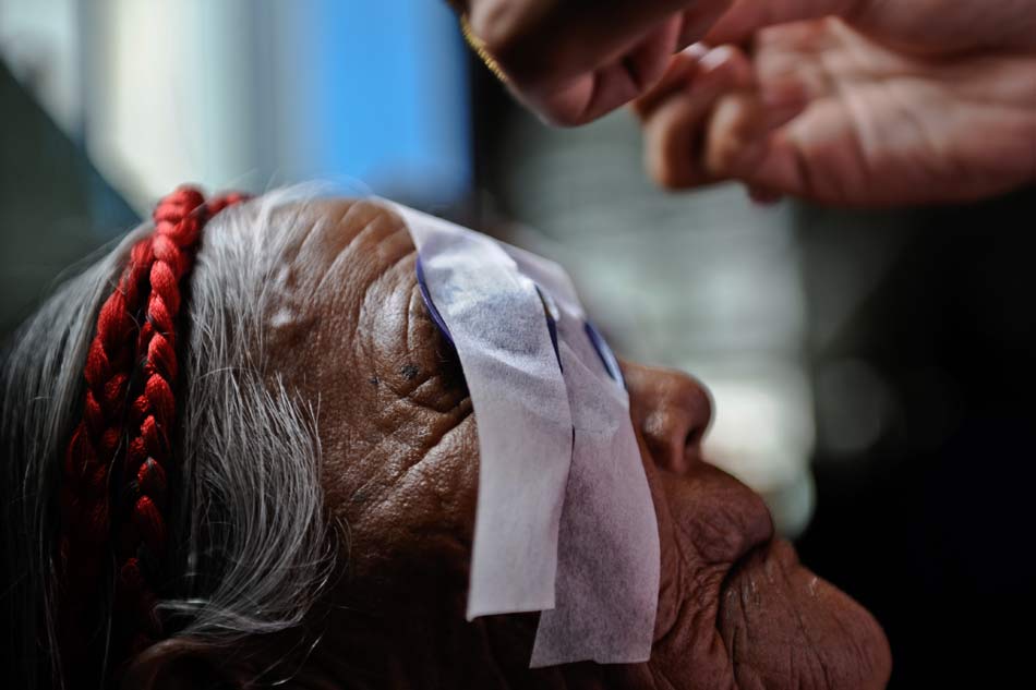 A Tibetan old lady waits for unlocking the goggles after cataract surgery on Aug. 30, 2012. From 1993, Tibet Development Fund started "Bright Project" aimed to cure cataract blind patients. More than 30,000 cataract patients from Tibet's remote and poor areas received free implementation of cataract surgery. (Xinhua)