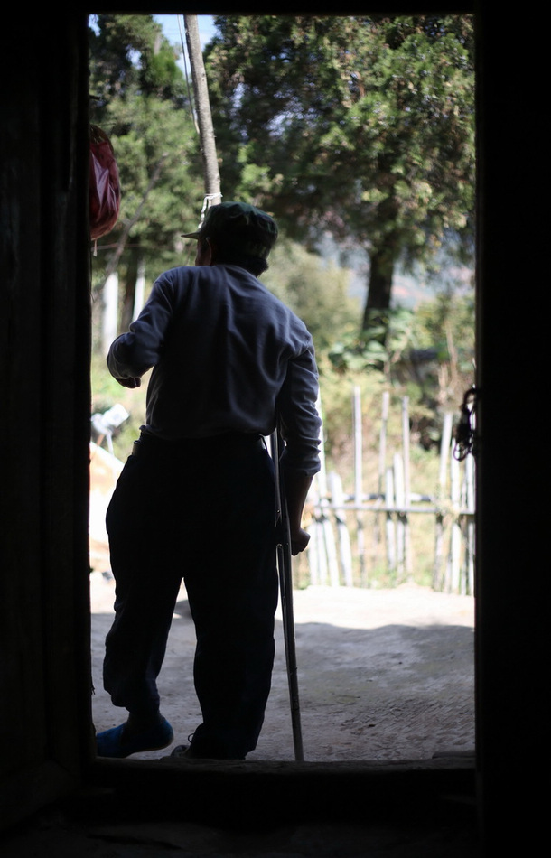 Yang Zike, 52, has suffered from leprosy for more than 30 years. His hands and feet have slowly improved. (Photo/Eastday)