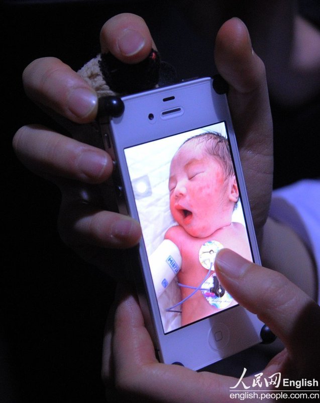 Lu Yuanfang, who has spinal muscular atrophy, gives birth to a premature boy in Beijing, Jan. 30. The birth marked a medical first in China. The mother and the son remain in the hospital under close observation.  (Photo/CFP) 