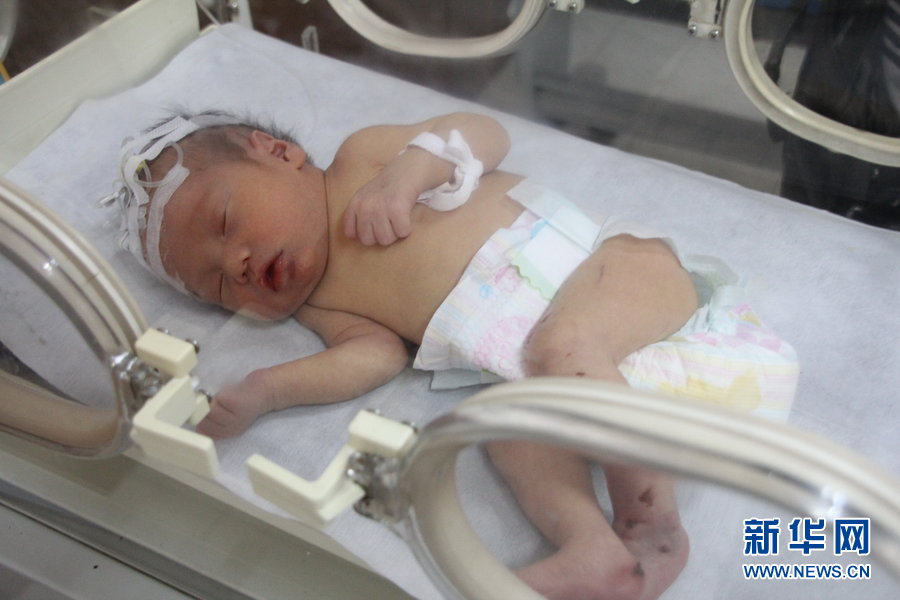 The baby receives medical treatment in a hospital in Zhejiang province on May 25, 2013 (Xinhua Photo)
