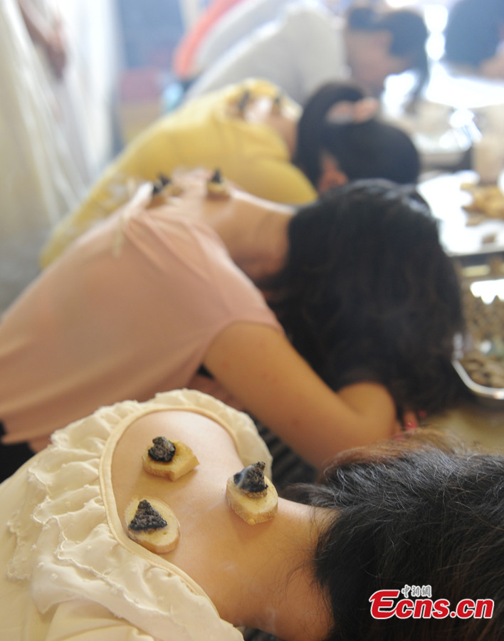 Citizens in Southeast China's Fujian province crowd into a local hospital to prevent or reduce the severity of winter ailments on July 23, 2013, during the three hottest periods, or dog days of summer. Treating winter diseases in summer is an ancient tradition in China. (CNS/ Liu Kegang)